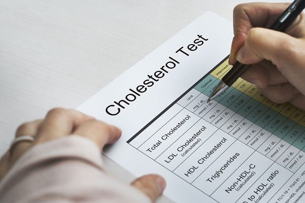 Nguy cơ suy giảm trí nhớ do nồng độ cholesterol cao bất thường