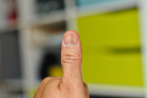 Thấy những triệu chứng này trên da và mắt nhất định phải đi khám ngay