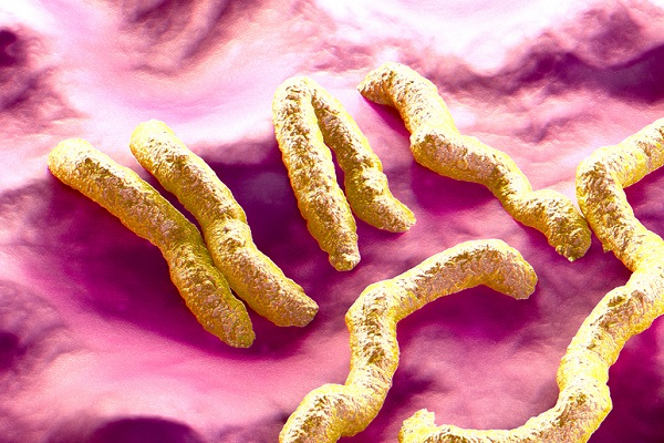 WHO cảnh báo một loại virus lây truyền gây tử vong 90%