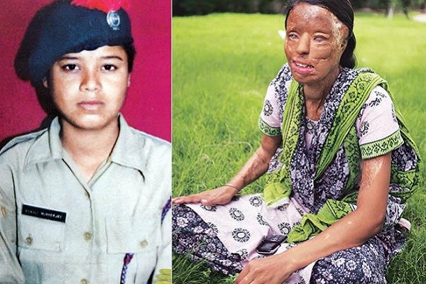 Cô gái Ấn Độ bị tạt axit tham gia ‘Ai là triệu phú’ để kiếm tiền phẫu thuật