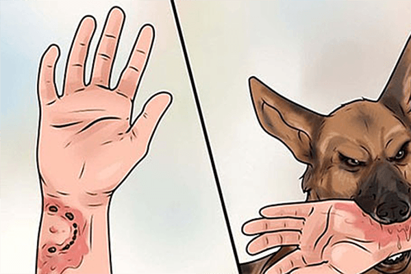 Quan niệm vắc xin phòng dại gây mất trí nhớ là sai lầm