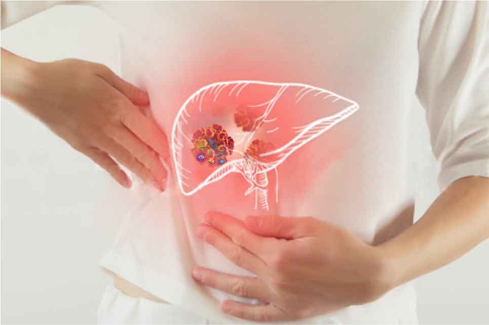 5 thói quen ăn uống khiến gia tăng các bệnh về gan