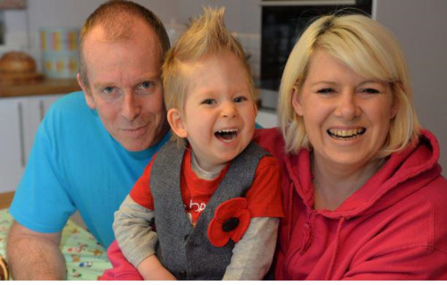 Cuộc sống luôn diệu kỳ đối với em bé không có não