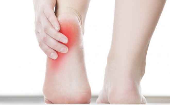 Bài thuốc trị bệnh gai gót chân
