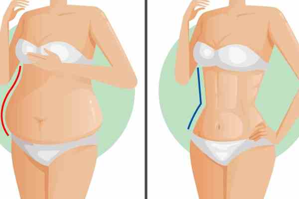 5 nguyên nhân hàng đầu gây tích tụ mỡ bụng