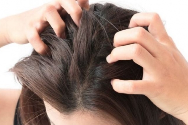 Mẹo trị ngứa da đầu cực hay, chỉ một tuần là hiệu quả