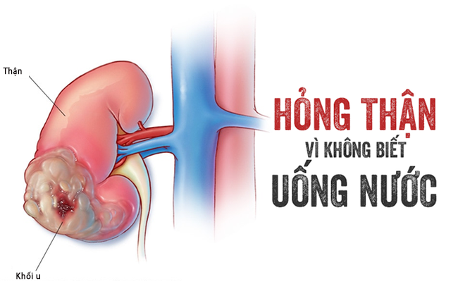 Những kiểu uống nước phá hủy thận