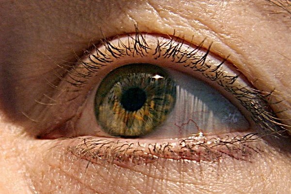 Dấu hiệu đầu tiên của Alzheimer xuất hiện ở mắt