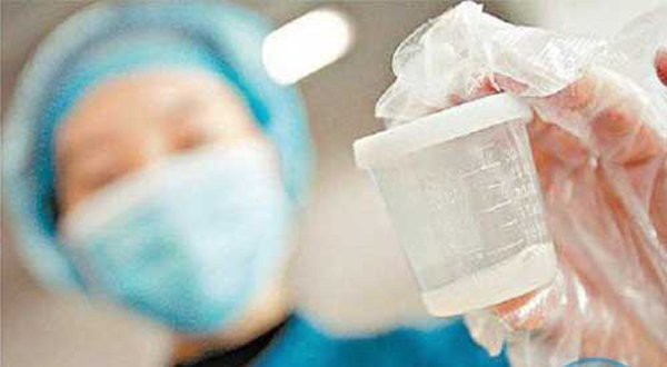 Người hiến tinh trùng ngày càng hiếm