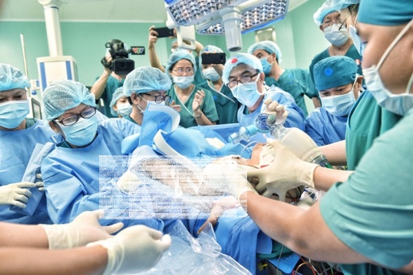 Đã tách rời thành công hai bé song sinh Trúc Nhi – Diệu Nhi