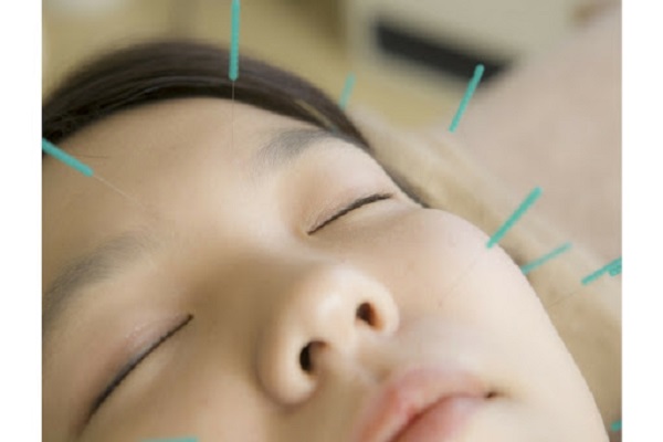 Liệt dây thần kinh số 7 thực sự nguy hiểm đến mức nào?