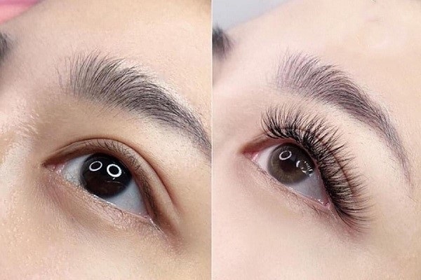 Cấy ghép lông mi, an toàn hay không?