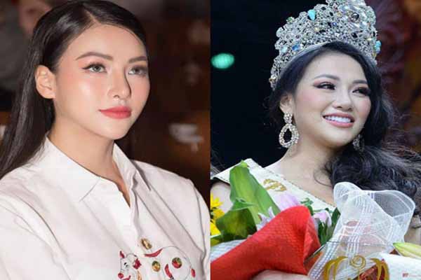 Hoa hậu Trái đất Phương Khánh lộ mũi dài bất thường