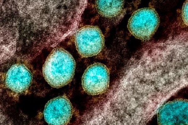 Tìm ra tế bào giúp bảo vệ con người trước SARS-CoV-2